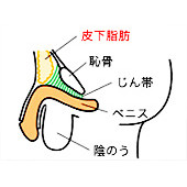 診療案内 包茎手術 亀頭強化 長茎術 他 横浜中央クリニック 横浜市西区 病院口コミ検索caloo カルー